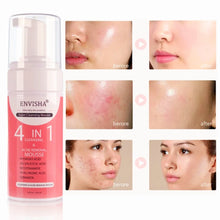 Load image into Gallery viewer, 4 in 1 acne removal mousse